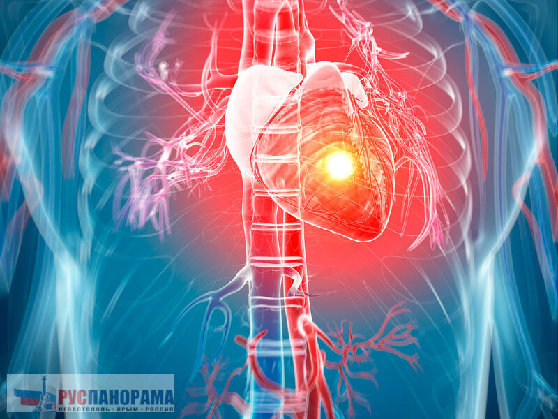 По состоянию рук, можно определить состояние сердца, и предвидеть сердечный приступ